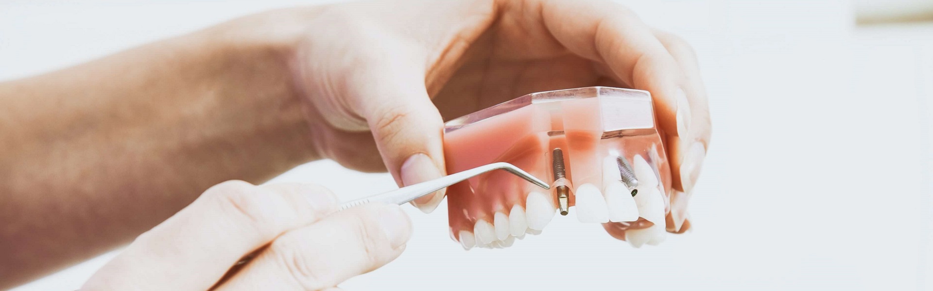 Iznajmljivanje auto dizalica | Zubni implanti Beograd